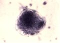 Morbillo, coperture vaccinali e prevenzione nei luoghi di vita e di lavoro